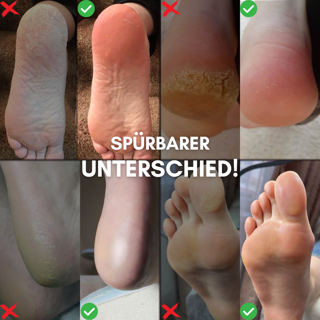 SoftFeet Pro - Effektive & schnelle Fußpflege