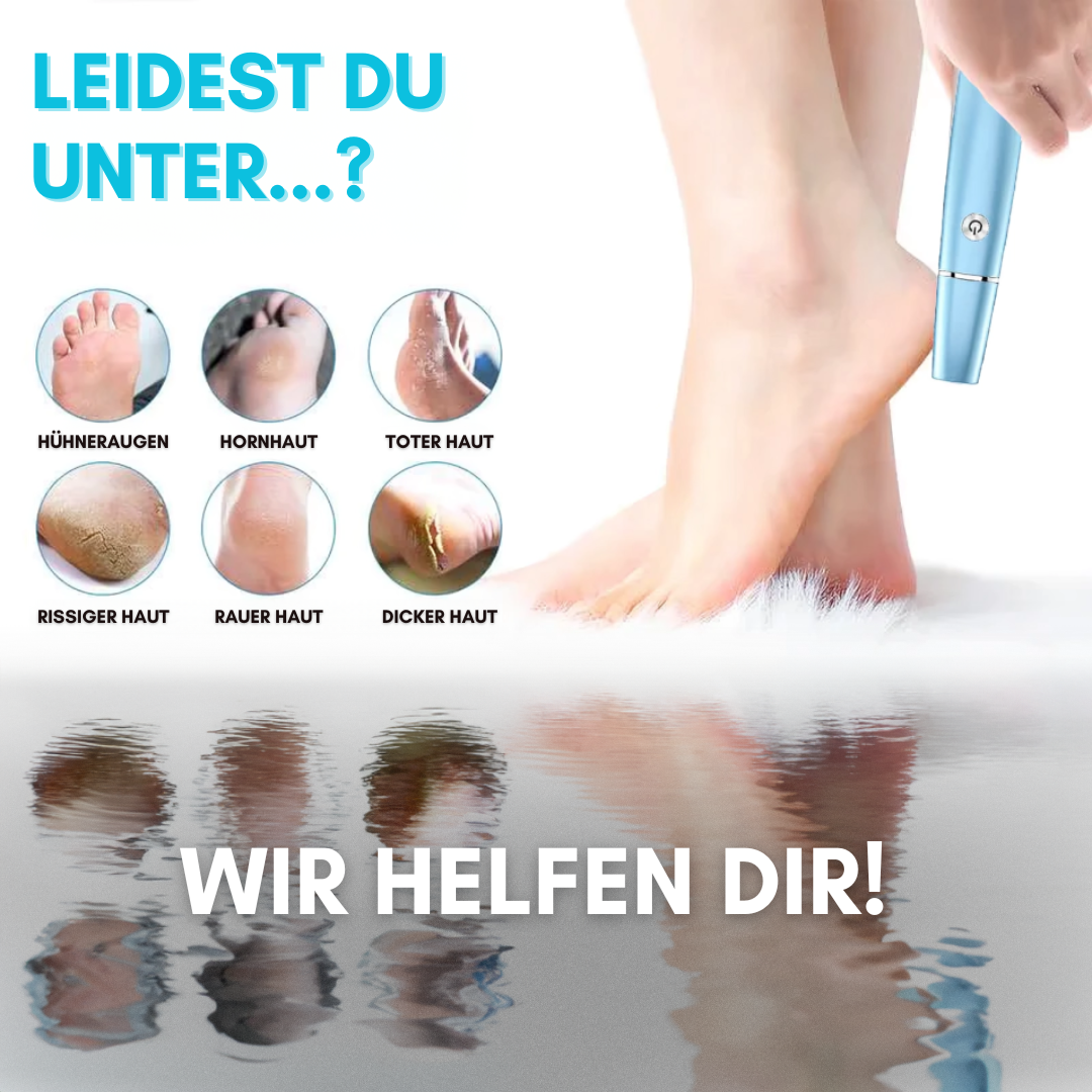 SoftFeet Pro - Effektive & schnelle Fußpflege